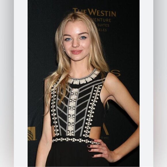 BCBGMaxAzria Adelia Gladiator Dress - Picture 8 of 14